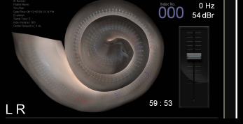 000.png
